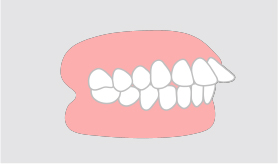 *